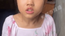 女孩2岁时基因突变双目失明 妈妈：产检时一切正常