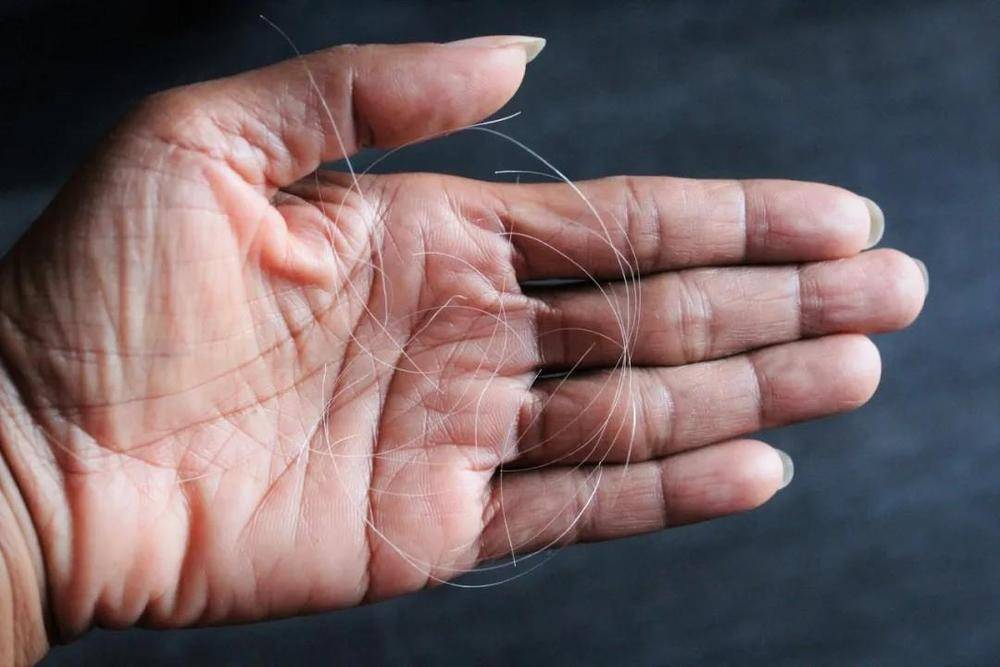 白头发拔一根长三根?到底能不能拔?终于弄清楚了