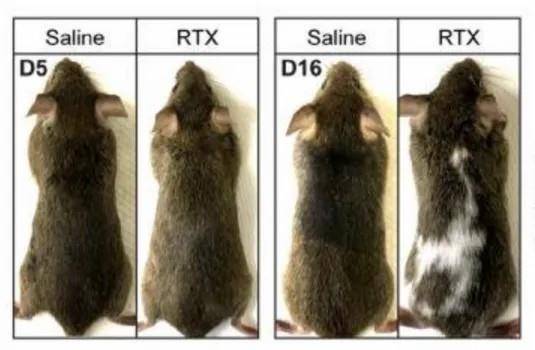 白头发拔一根长三根?到底能不能拔?终于弄清楚了